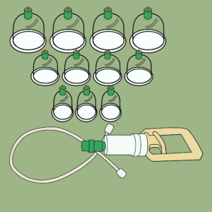 Unani Hijama (Module 4)